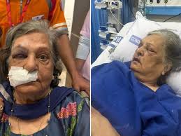 Photo of एयर इंडिया से बुजुर्ग महिला को नहीं मिली व्हीलचेयर, गिरने से आईसीयू में भर्ती…