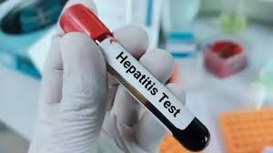 Photo of कुलगाम गाँव में तीन भाई-बहन हेपेटाइटिस से संक्रमित , एक की मौत…