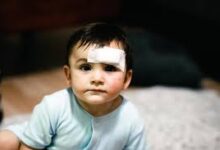 Photo of सूझबूझ और समझदारी के साथ करें बच्चों की चोट का इलाज