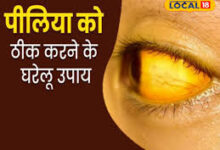 Photo of कुदरती तरीकों से पाएं पीलिया से राहत