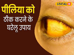 Photo of कुदरती तरीकों से पाएं पीलिया से राहत
