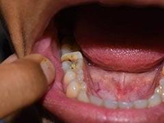 Photo of दांत-मसूड़ों के दर्द से छुटकारा पाने में काम आएंगे ये घेरलू उपाय..